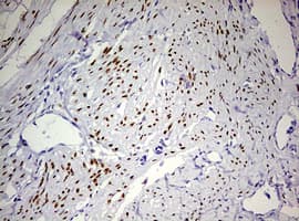 PR / Progesterone Receptor Antibody (aa1-298, clone OTI4B3)