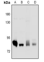 PRKCD / PKC-Delta Antibody