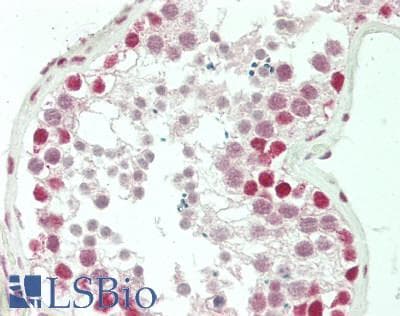 IHC-plus™ CREBBP / CREB Binding Protein Antibody (C-Terminus)