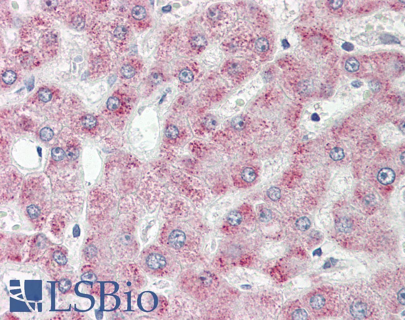 PECR Antibody