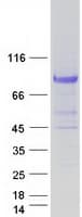 Human MPEG1 Protein (Recombinant Myc-DDK (Flag))