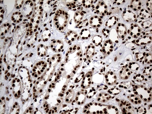Monoclonal Mouse anti-Human HNRNPH1 / hnRNP H Antibody (clone OTI1H3, IHC, WB)
