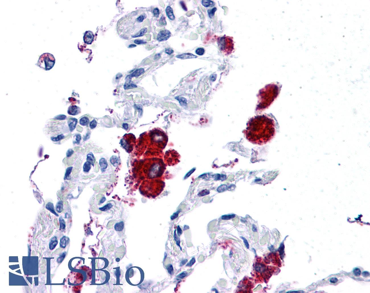 Monoclonal Mouse anti-Human HLA-G Antibody (clone 2A12, C-Terminus, IHC, WB)