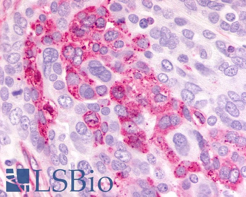 IHC-plus™ CXCR2 Antibody (N-Terminus)