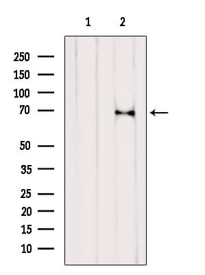 RPN1 / Ribophorin I Antibody