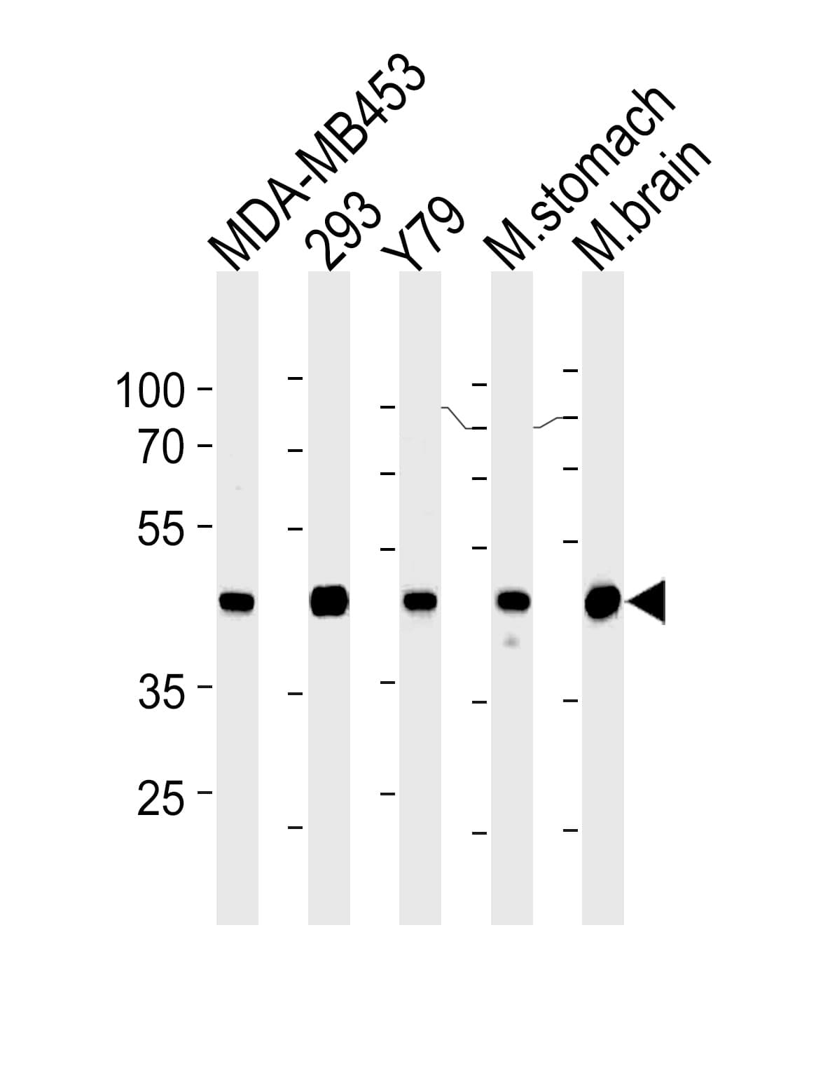 Monoclonal Mouse anti-Human CKB / Creatine Kinase BB Antibody (clone 893CT29.1.1, WB)