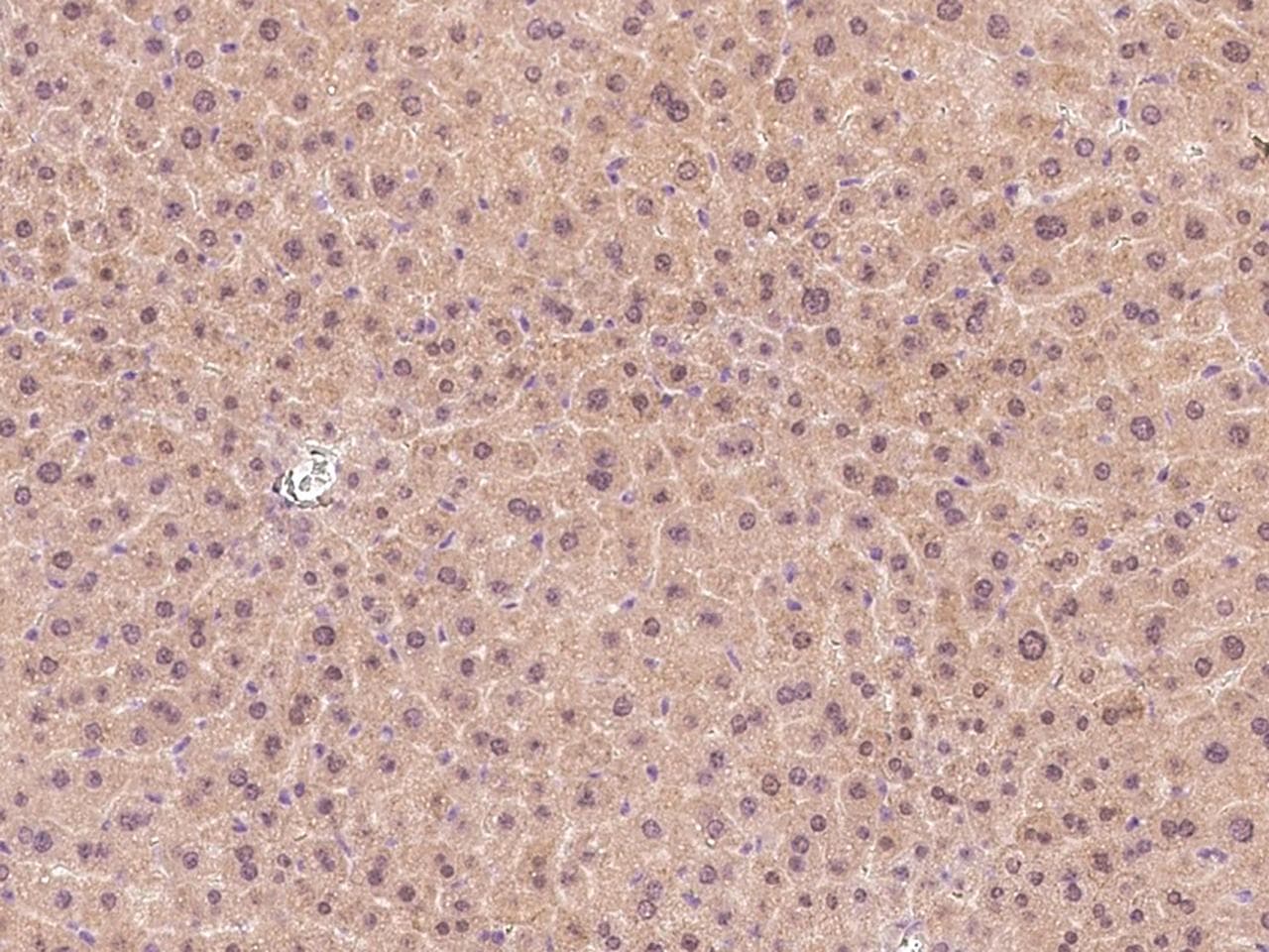 LEPR / Leptin Receptor Antibody