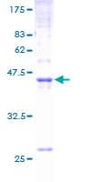 Human CLDN4 / Claudin 4 Protein (Recombinant GST)