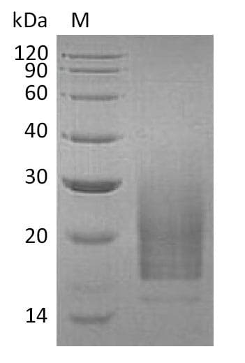 Human IL3 Protein (Recombinant 6His, C-terminus)