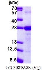 Human LY6G6F Protein (Recombinant His)