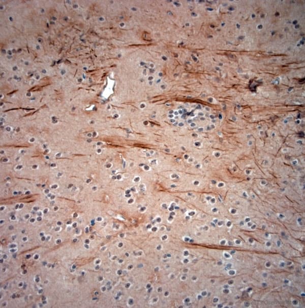 NEFH / NF-H Antibody (aa150-200)