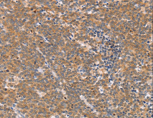 CD2AP Antibody