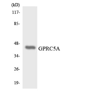 GPRC5A / RAI3 Antibody (aa130-179)