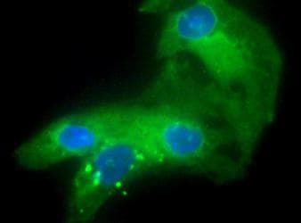 EGLN1 / PHD2 Antibody (Internal, DY650)