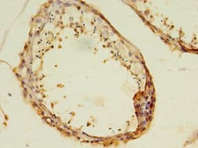 MAS1 / MAS Antibody (aa285-352, Biotin)