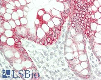 IHC-plus™ Polyclonal Guinea pig anti-Human KRT19 / CK19 / Cytokeratin 19 Antibody (IHC, IF, WB)