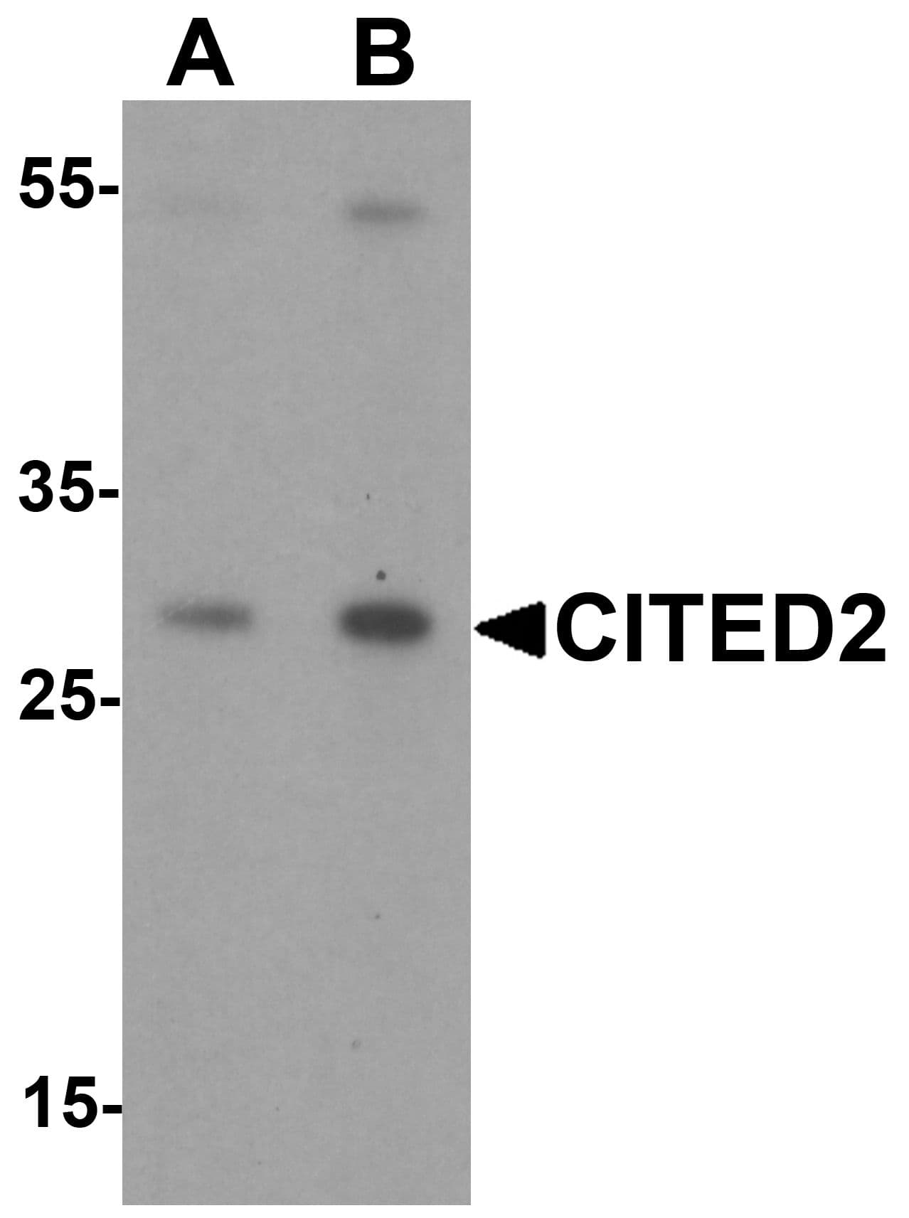 IHC-plus™ CITED2 Antibody