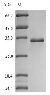 Human BCMP84 / S100A14 Protein (Recombinant 6His-SUMO, N-terminus)