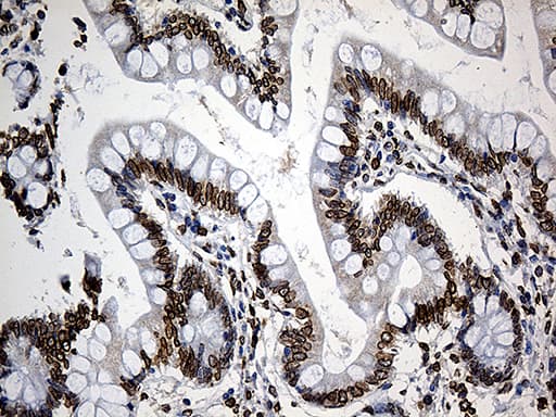 SLU7 / 9G8 Antibody (aa1-300, clone OTI6B1)
