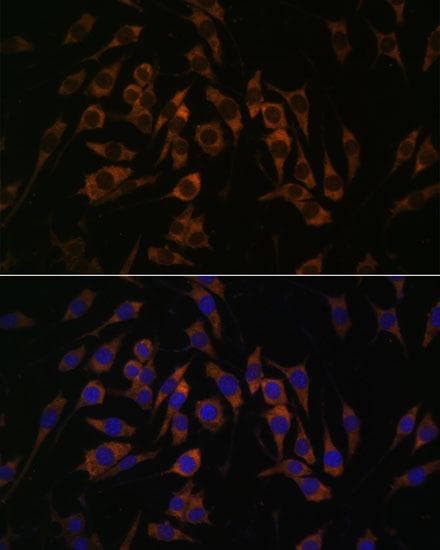 RPS13 / Ribosomal Protein S13 Antibody