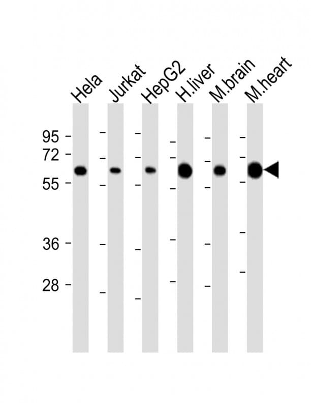 Polyclonal Rabbit anti-Human PGM1 / Phosphoglucomutase 1 Antibody (aa251-282, IHC, WB)