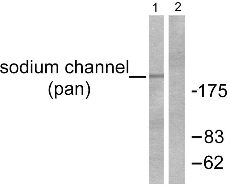 SCN5A / Nav1.5 Antibody