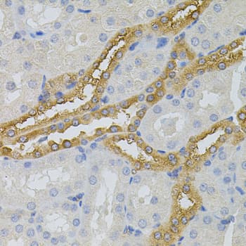 PFKP Antibody
