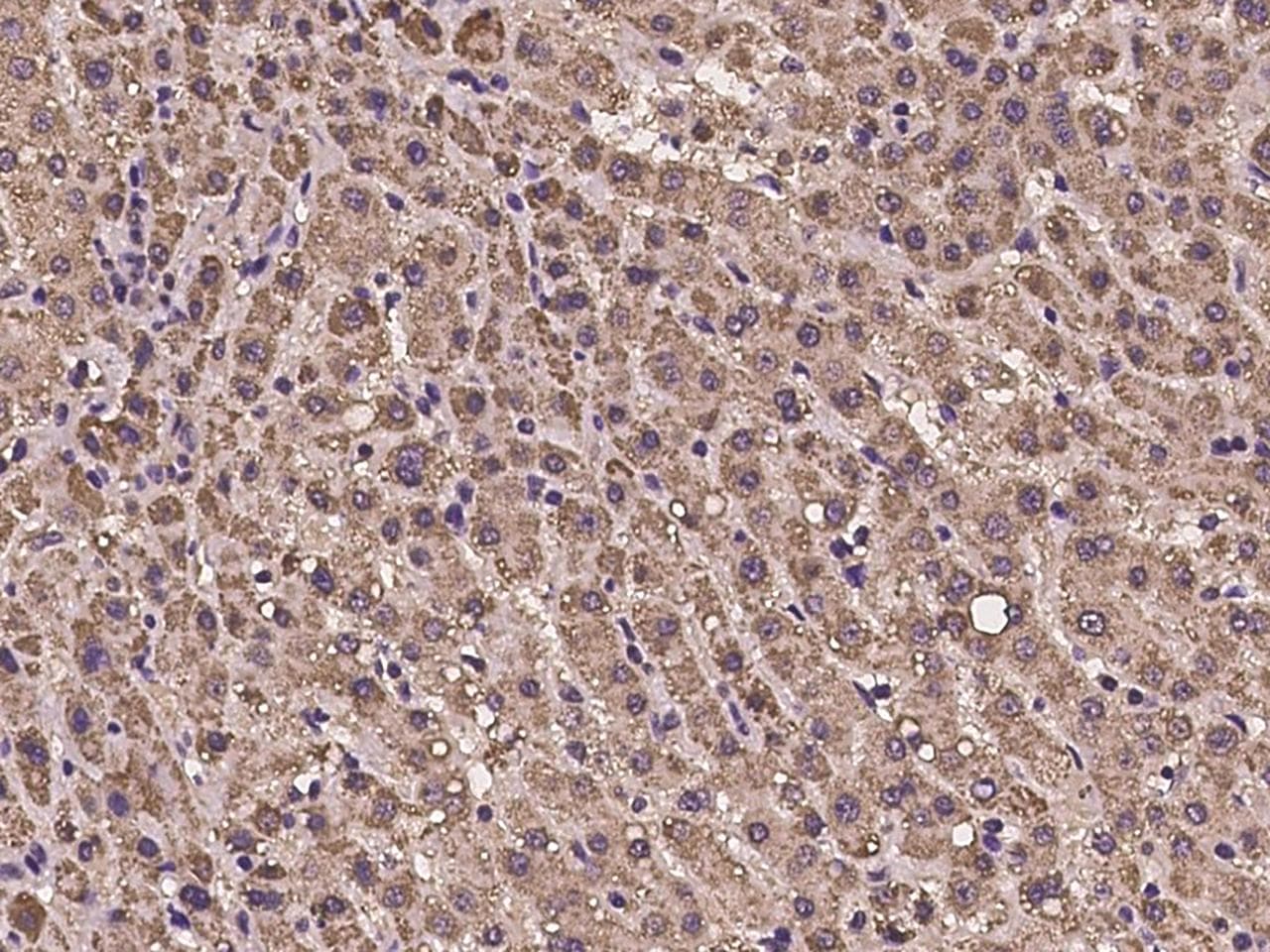 PDPK1 / PDK1 Antibody