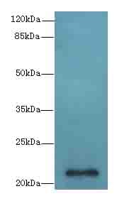 EPO / Erythropoietin Antibody