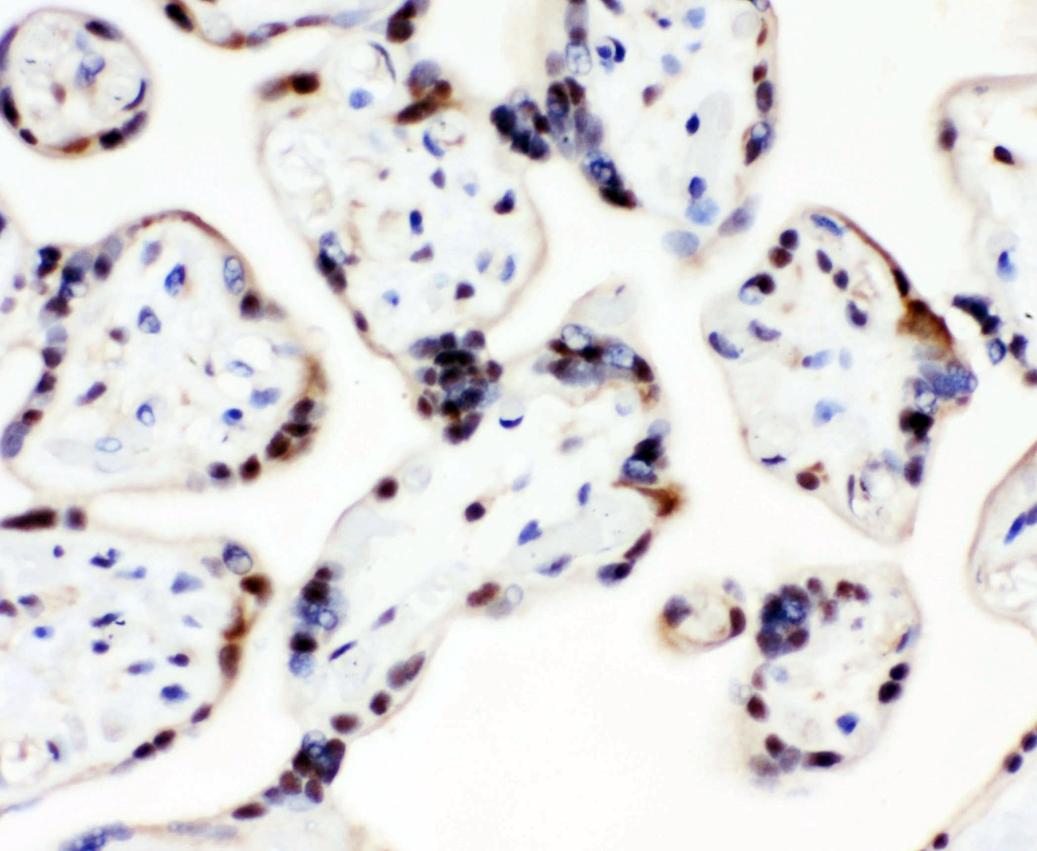 Polyclonal Rabbit anti-Human CCT3 Antibody (IHC, WB)