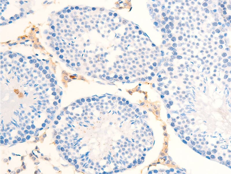 ERBB2 / HER2 Antibody (phospho-Tyr877)