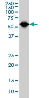 TCF3 / E2A Antibody (clone 5G2)