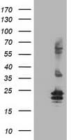 FGF21 Antibody (aa29-209, clone OTI9A7, Carrier-free)
