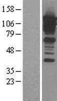 CAST / Calpastatin Protein (Over-Expression Lysate Myc-DDK (Flag))