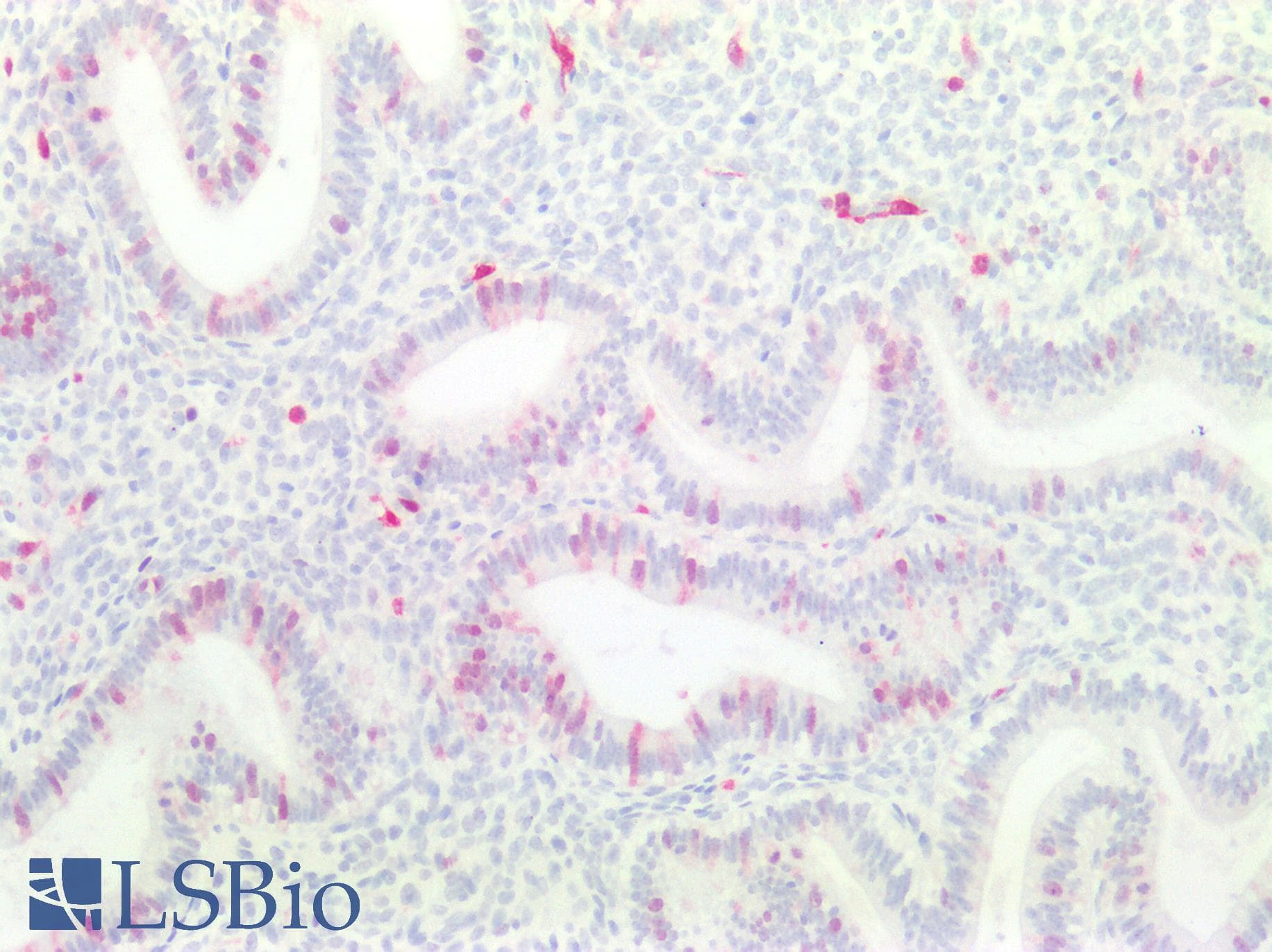 PathPlus™ TS / Thymidylate Synthase Antibody (clone 3F1)