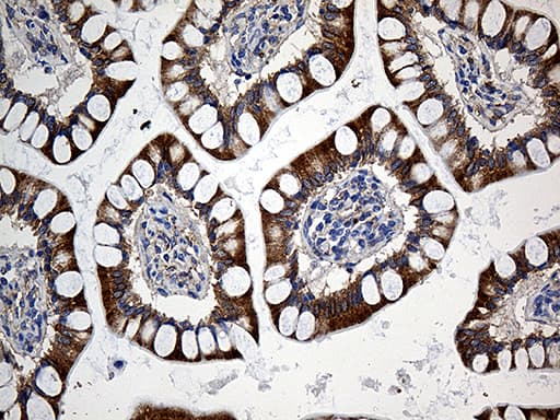 SLC9A1BP / CHP Antibody (clone OTI3H3)