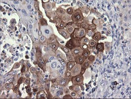 PIK3R5 Antibody (clone OTI4B11, Carrier-free)