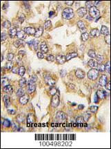 VILIP / VSNL1 Antibody (aa123-150)