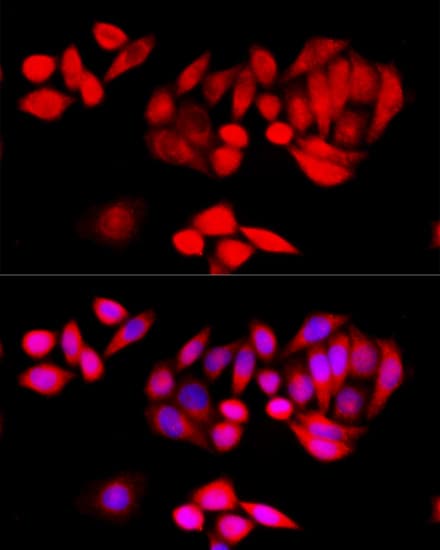 TGFB1 / TGF Beta 1 Antibody