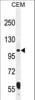 Polyclonal Rabbit anti-Human LARS2 / LEURS1 Antibody (aa418-446, WB)