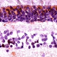 Polyclonal Rabbit anti-Human ARR3 / Cone Arrestin Antibody (C-Terminus, IHC, IF, WB)