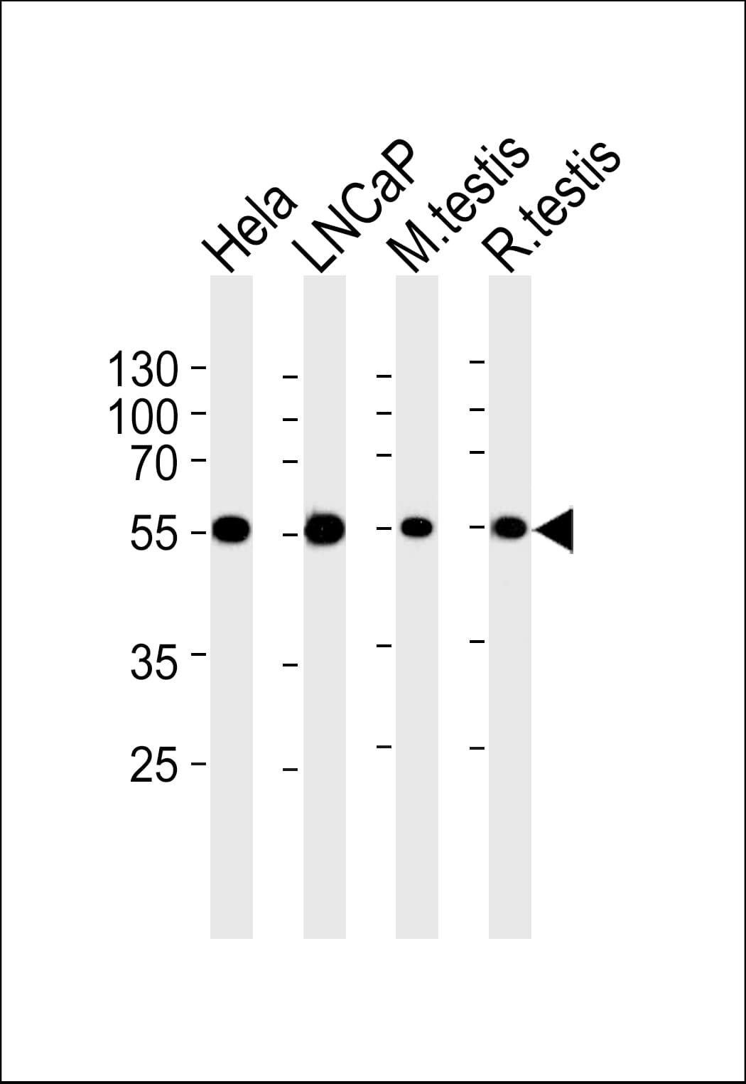 ULK3 Antibody (aa435-468, clone 1404CT148.89.25)