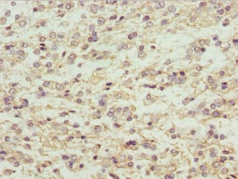 MAGED1 / NRAGE Antibody