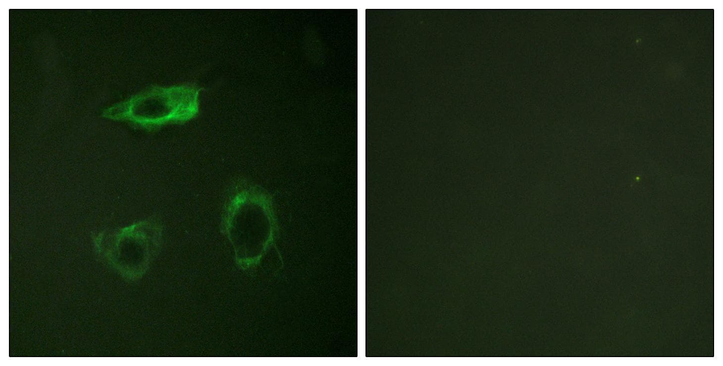 ITGB2 / CD18 Antibody (phospho-Thr758)