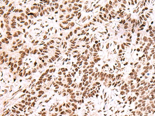 FOXK2 / ILF Antibody