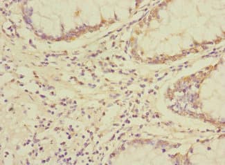 Polyclonal Rabbit anti-Human NAG20 / UBAP1 Antibody