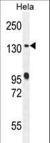Polyclonal Rabbit anti-Human DENND5A Antibody (aa695-724, WB)