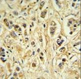 ZNF202 Antibody (aa342-370)