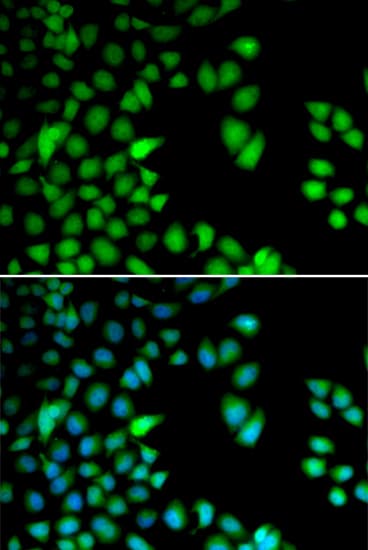 RPS6KA3 / RSK2 Antibody