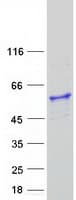 Human ATP6V1H Protein (Recombinant Myc-DDK (Flag))